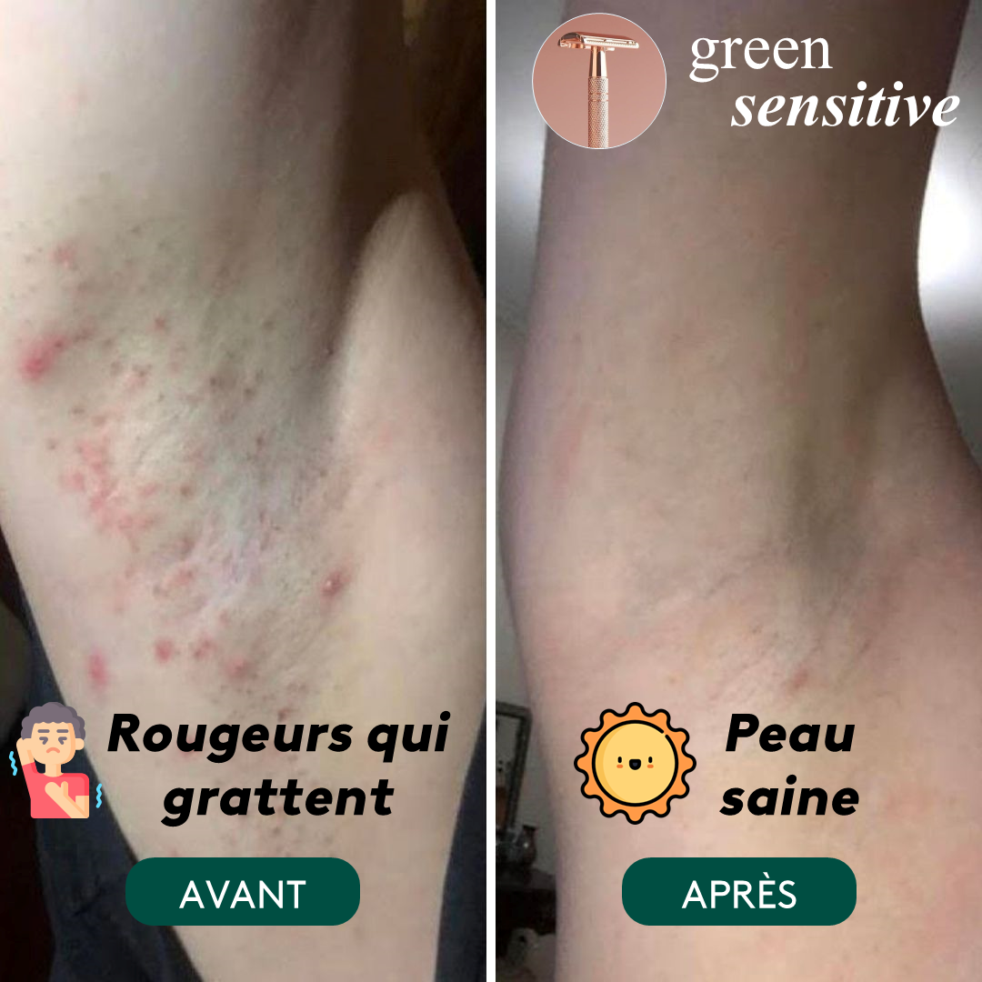 Rasoir de Sûreté Green Sensitive, pour peaux sensibles